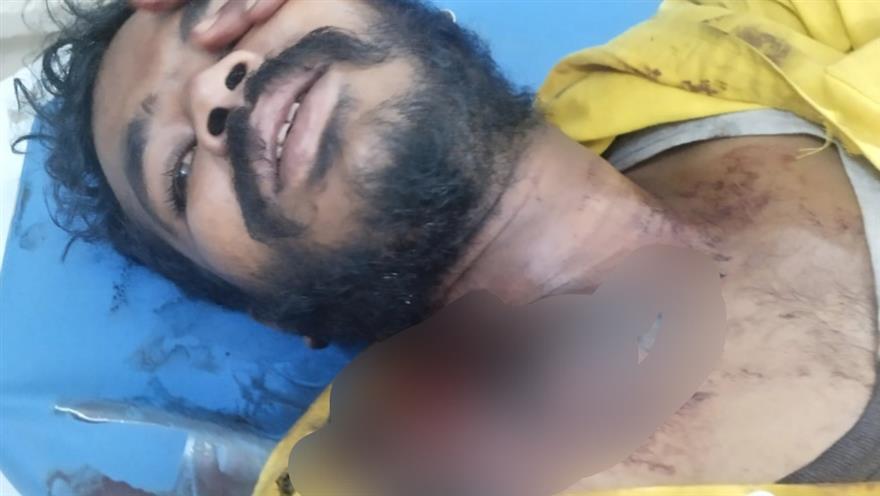 ಕುಡಿದ ಮತ್ತಿನಲ್ಲಿ ತನಗೆ ತಾನೆ ಗುಂಡು ಹೊಡಕೊಂಡ