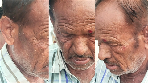 ಪಾರ್ಕಿನಲ್ಲಿ ಜೇನುನೊಣಗಳ ದಾಳಿ: ನಾಲ್ವರಿಗೆ ಗಾಯ