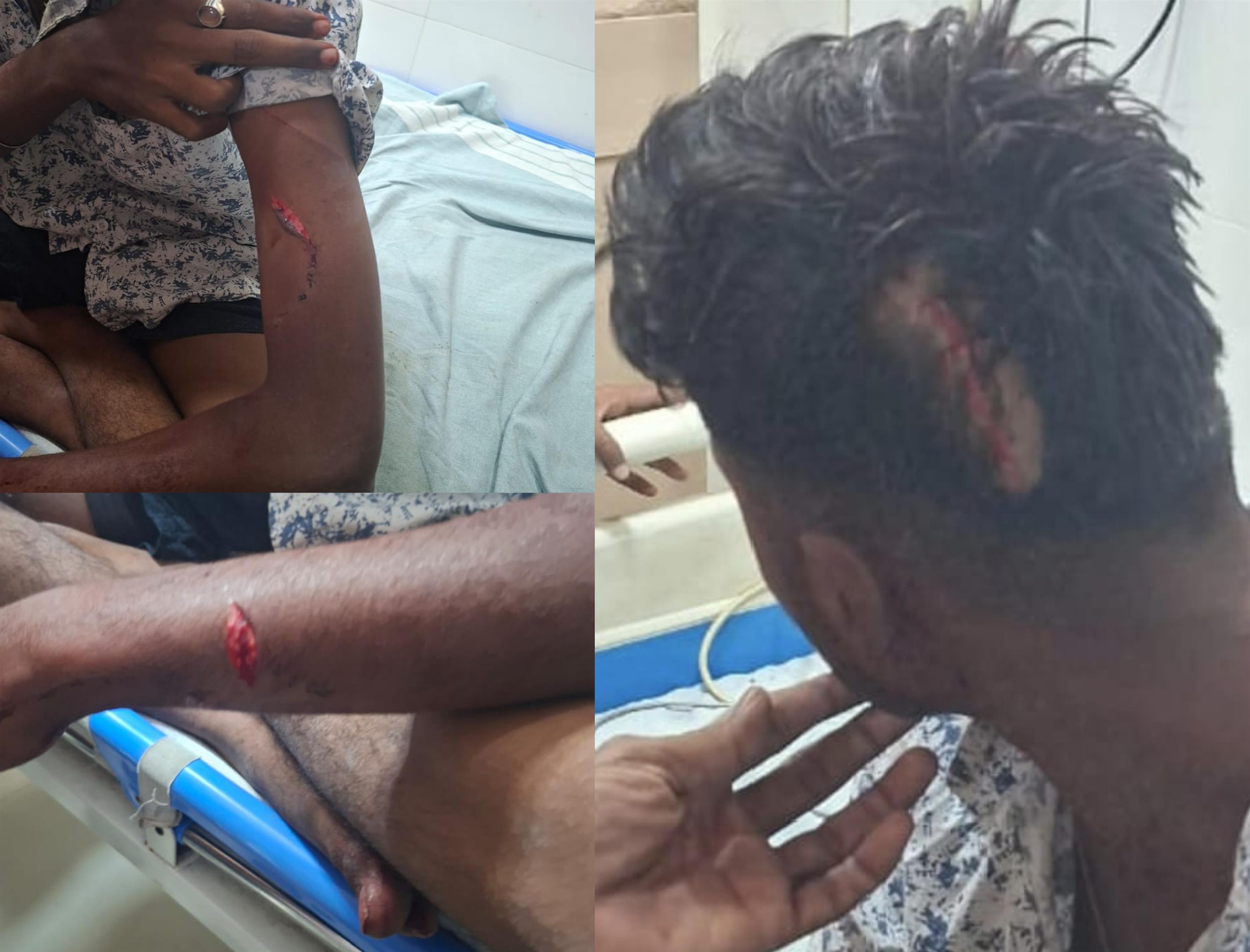 ಗಂಗಾವತಿ: ಇಸ್ಲಾಂಪುರದ ಆ 'ಕತ್ತಲ' ಗಲ್ಲಿಯಲ್ಲಿ ನಡೆದಿದ್ದೇನು?: ಗುರಾಯಿಸಿದ್ರೆ ಬೀಳುತ್ತೆ ಚಾಕು!