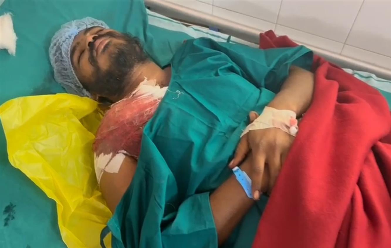 ಕೊಪ್ಪಳ: ಕುಡಿದ ಮತ್ತಲ್ಲಿ ಗುಂಡು ಹಾರಿಸಿಕೊಂಡ ಆಸಾಮಿ,  ಅಕ್ರಮ ಶಸ್ತ್ರಾಸ್ತ್ರ ಪ್ರಕರಣ ದಾಖಲು.